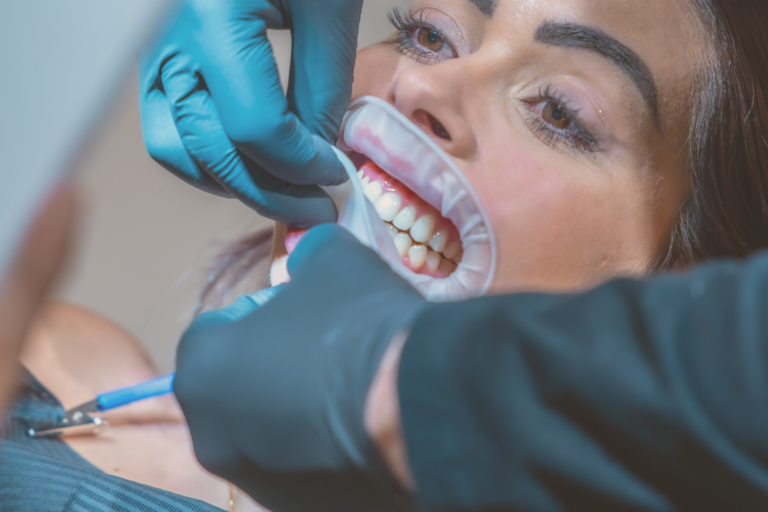 blanqueamiento dental