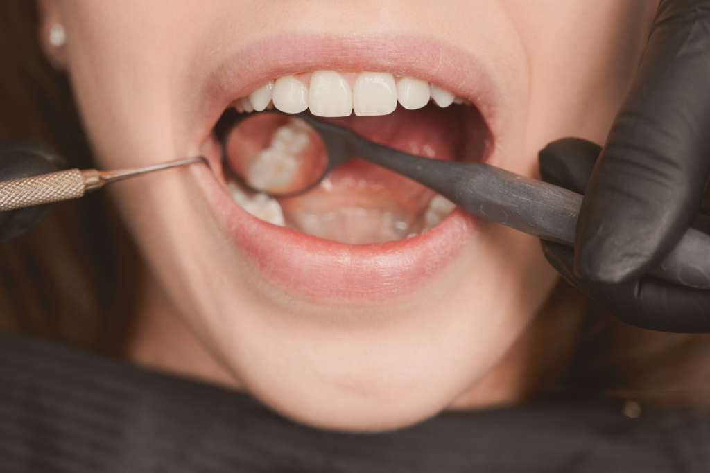 limpieza dental