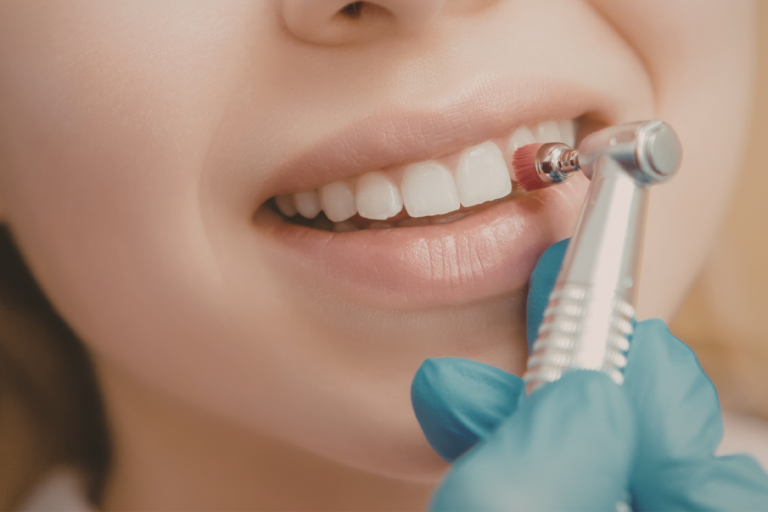 resinas dentales